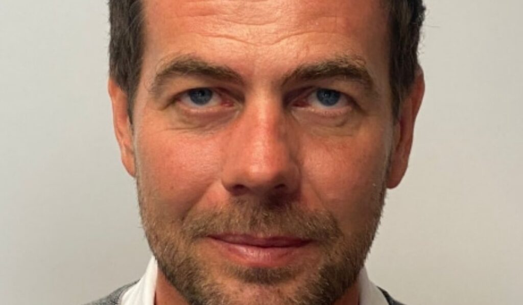 best hair transplant uk